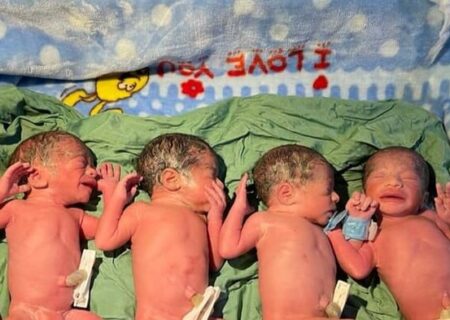 تولد نوزادان چهار قلو در آبادان