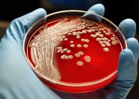 شناسایی یک آنتی‌بیوتیک جدید برای مبارزه با باکتری‌های خطرناک و مقاوم