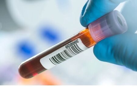 تلاش محققان برای تشخیص سرطان با استفاده از آزمایش خون
