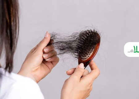 چگونه بدانیم ریزش موی سر غیرطبیعی است