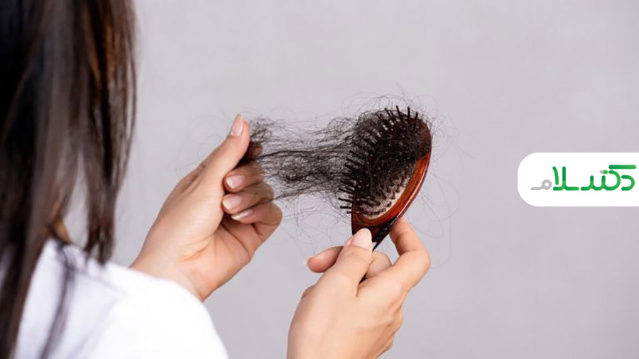 چگونه بدانیم ریزش موی سر غیرطبیعی است