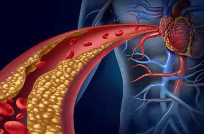 «کلسترول» و «تری گلیسیرید» چه تفاوت‌هایی دارند؟