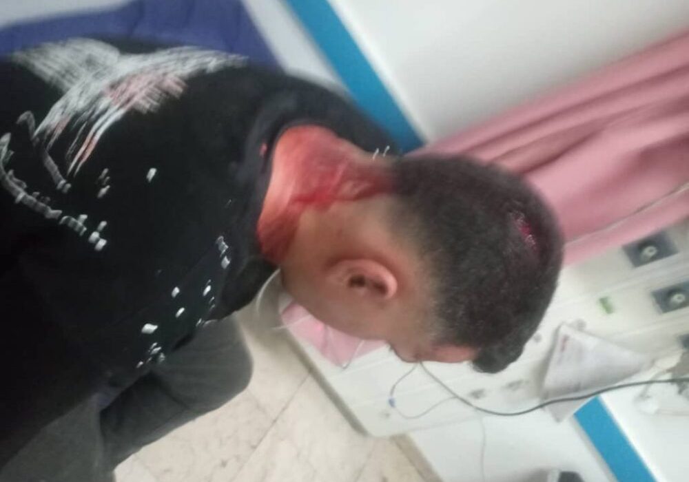 حمله دستفروشان به مأموران اجرائیات شهرداری مسجدسلیمان باعث جراحت شدید یکی از کارکنان شد