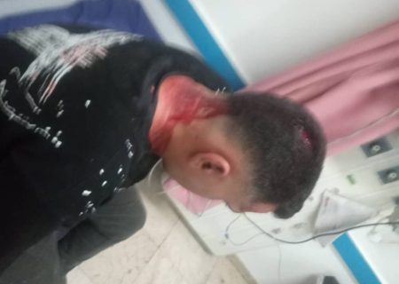 حمله دستفروشان به مأموران اجرائیات شهرداری مسجدسلیمان باعث جراحت شدید یکی از کارکنان شد