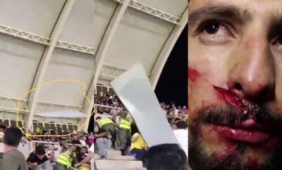 خطای انسانی، عامل اصلی حادثه ورزشگاه پارس