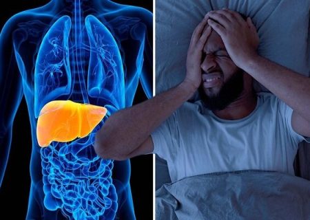 ۳ بیماری افزایش دهنده خطر مرگ ناشی از کبد چرب