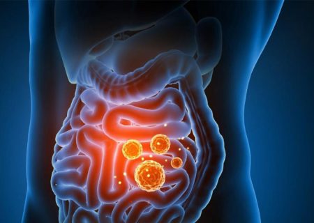 داروهای رایج مانند قرص سرماخوردگی و دیازپام می‌توانند تا سال‌ها بر سلامت روده اثر بگذارند