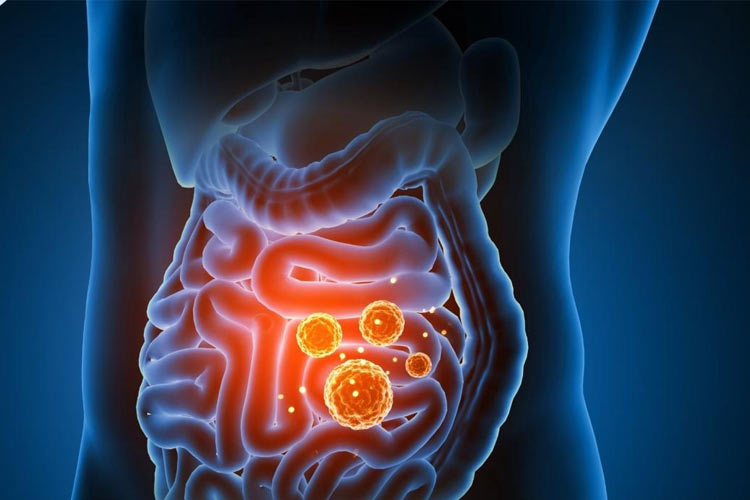 داروهای رایج مانند قرص سرماخوردگی و دیازپام می‌توانند تا سال‌ها بر سلامت روده اثر بگذارند