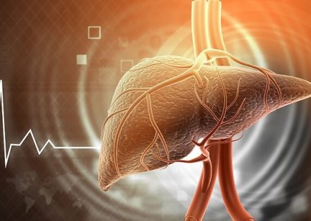 علائم ظاهری بالا بودن آنزیم های کبدی / بالا رفتن آنزیم های کبدی نشانه چیست ؟