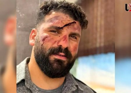 عکس میلاد کرمی بلاگر معروف به وضعتان چونه بعد از سقوط از کوه ../ اینبار وضعتان خرابه …