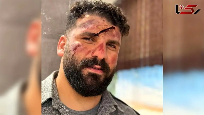عکس میلاد کرمی بلاگر معروف به وضعتان چونه بعد از سقوط از کوه ../ اینبار وضعتان خرابه …